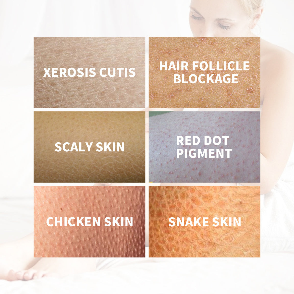 KP Repair Cream - Keratosis Pilaris Treatment for Smooth Skin
