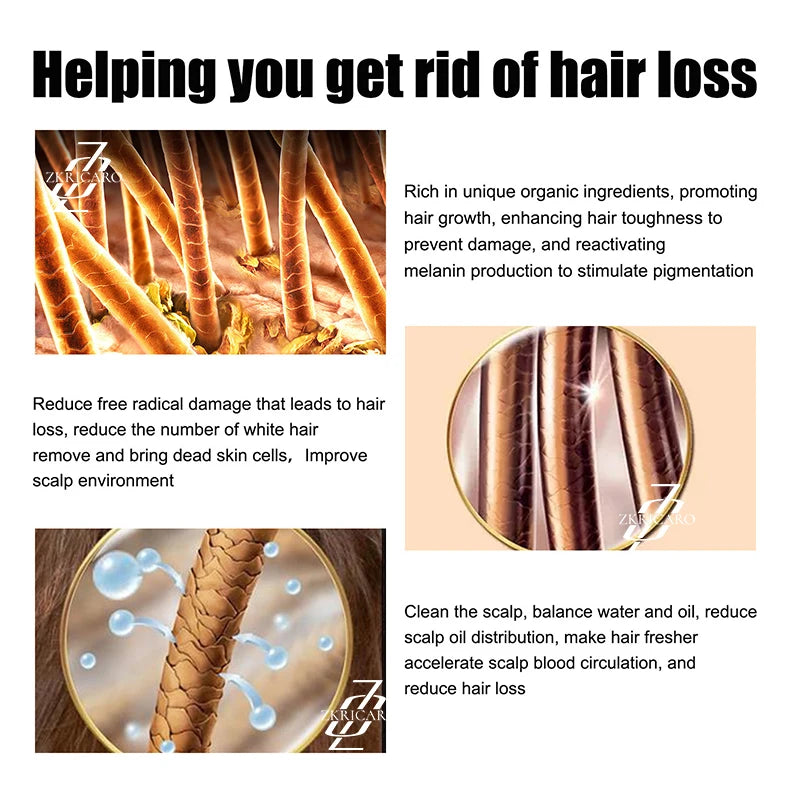 Hair Root Growth Serum - Strengthen & Revitalize Beautiful Hair