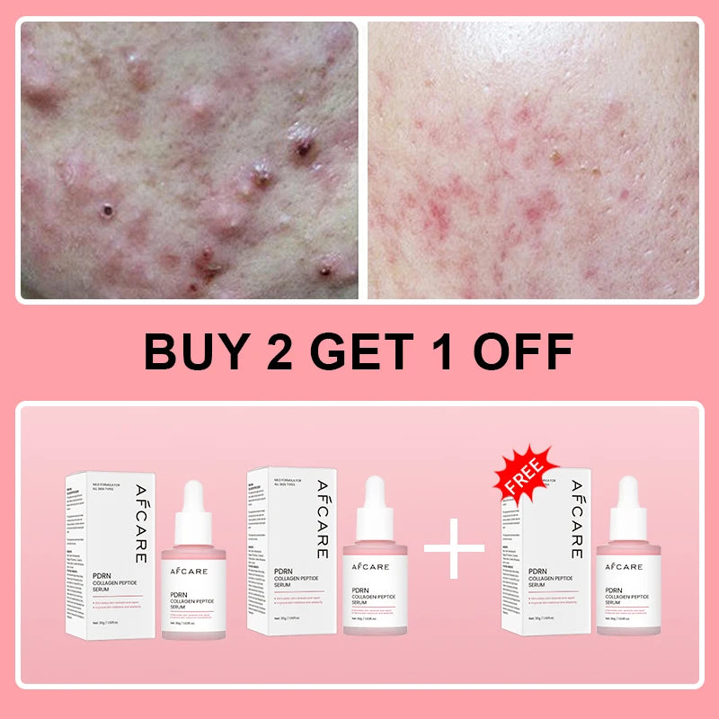 Premium Collagen Peptide Facial Serum