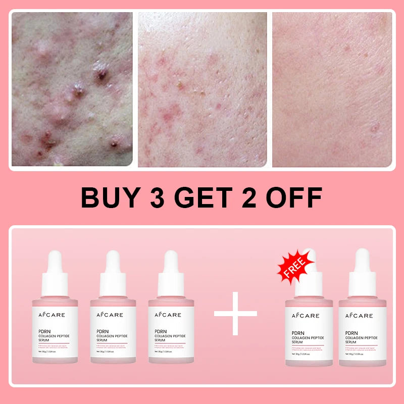 Premium Collagen Peptide Facial Serum