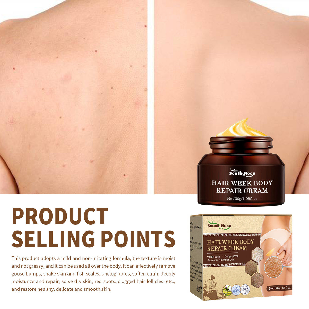 KP Repair Cream - Keratosis Pilaris Treatment for Smooth Skin